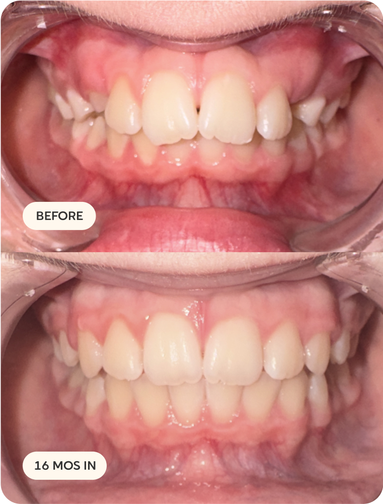 Before and after transformation