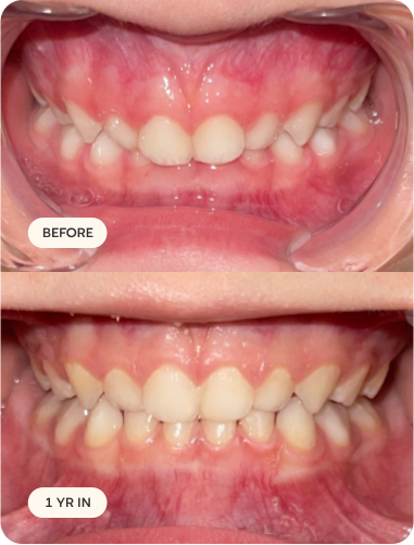 Before and after transformation