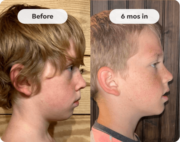 Patient result