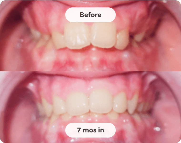 Patient result